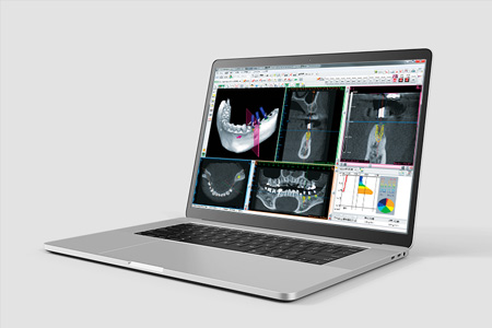 BIOFIX PLANNING ラインナップ BIOFIX PLANNING ラインナップ
