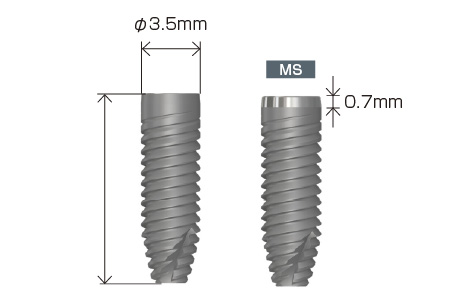 インプラント φ3.5mm インプラント φ3.5mm