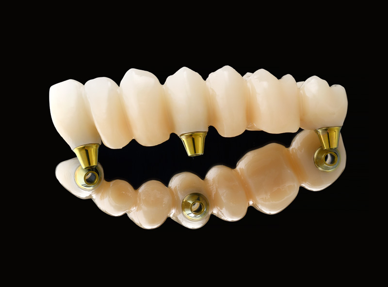 デジタルソリューション -松風バイオフィックス-