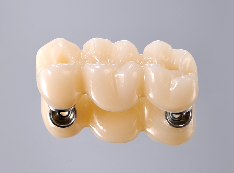 デジタルソリューション -松風バイオフィックス-